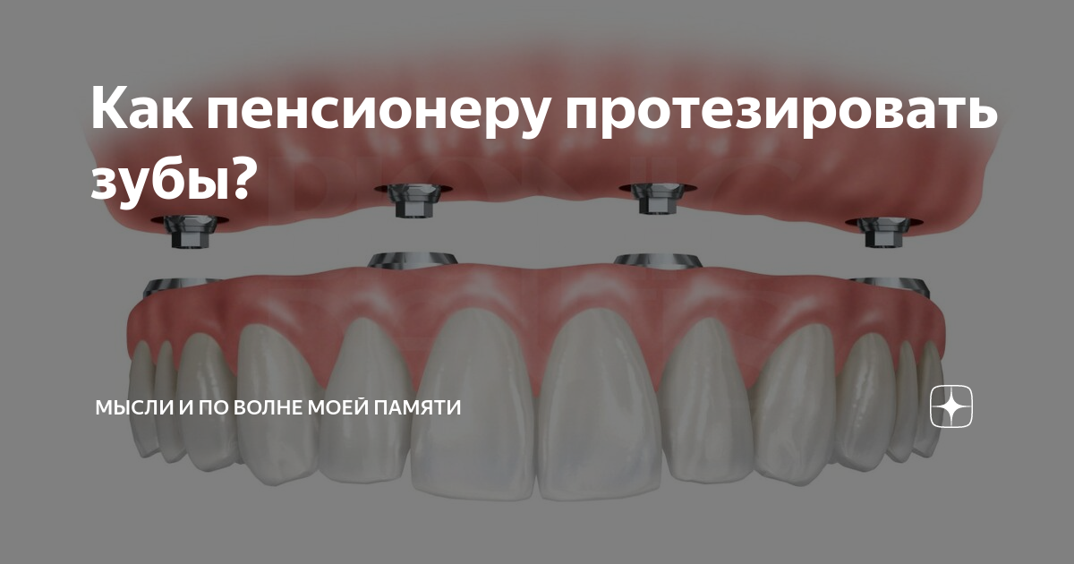 Как пенсионеру протезировать зубы? | Мысли и по волне моей памяти | Дзен