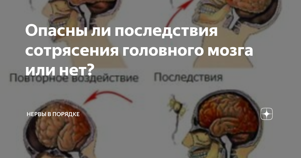 Симптомы сотрясения мозга у взрослых после удара. Осложнения при сотрясении головного мозга. Последствия сотрясения. Последствия сотрясения головного.