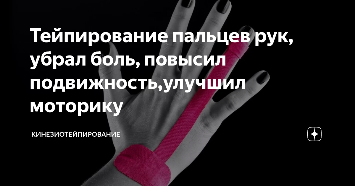 Тейпирование контрактура дюпюитрена. Тейпирование сустава большого пальца руки. Кинезио-тейп 2,5 см х 5 м. Тейпирование пальца на руке. Тейпирование указательного пальца руки.