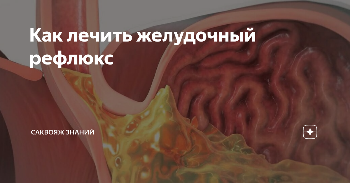 Лечение клапана желудка