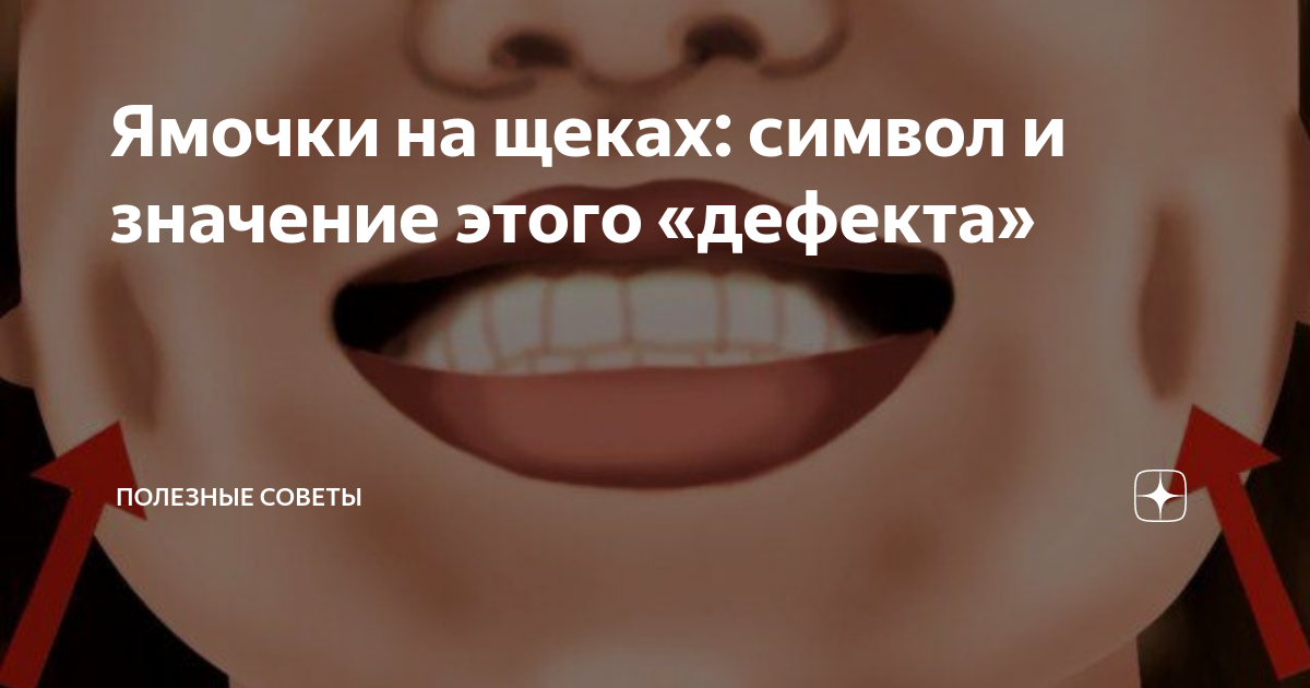 Ямочки на щеках — Википедия