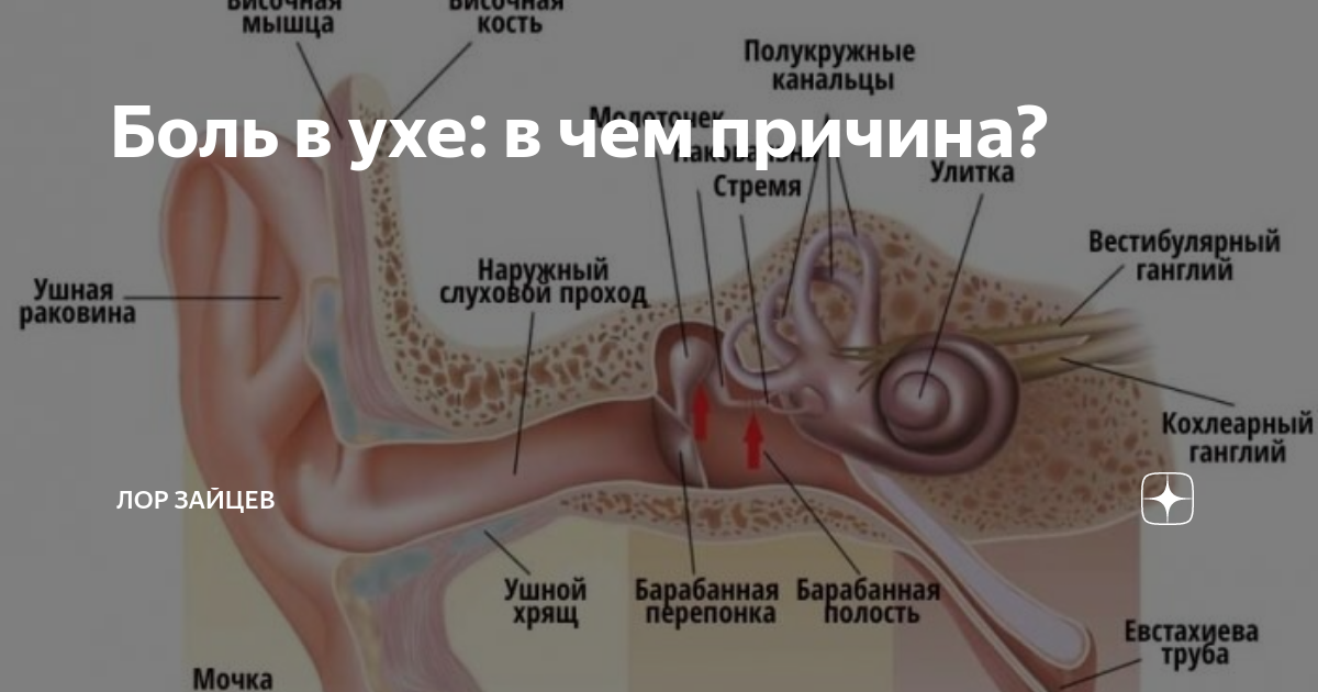 Болит сильно правое ухо что делать. Ноющая боль в ухе причины. Дискомфорт в ухе с одной стороны.