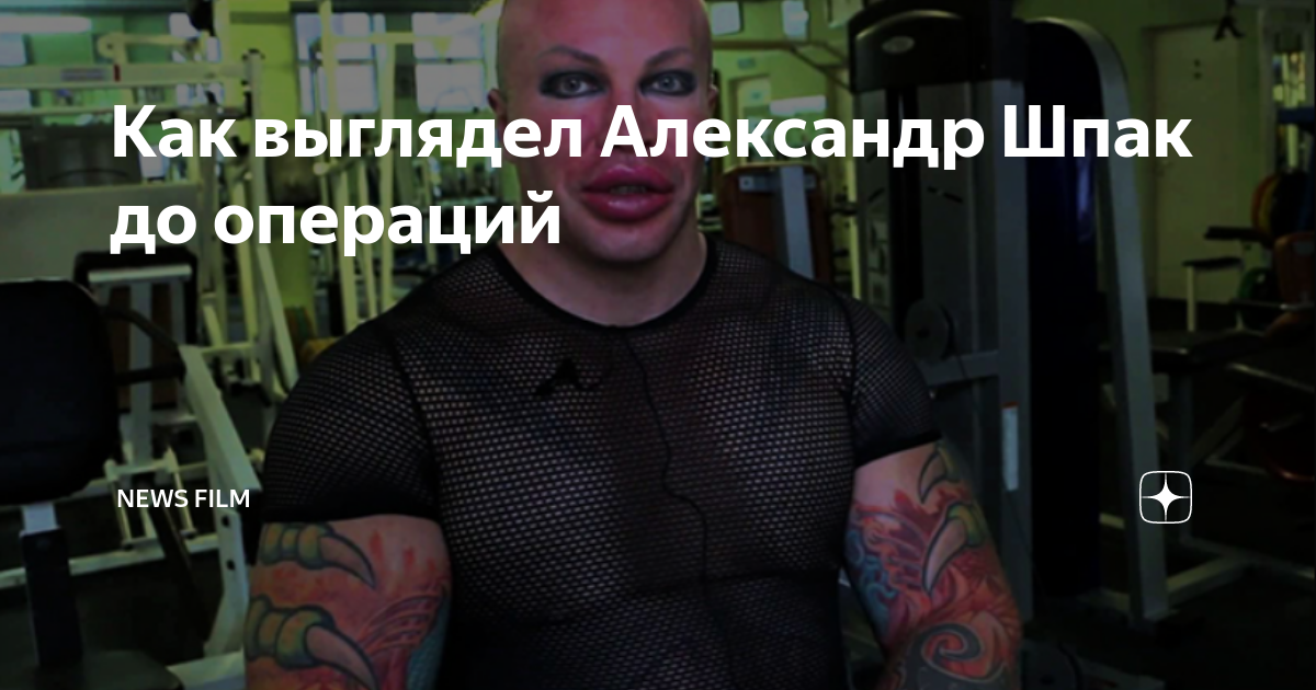 Александр шпак до и после операции