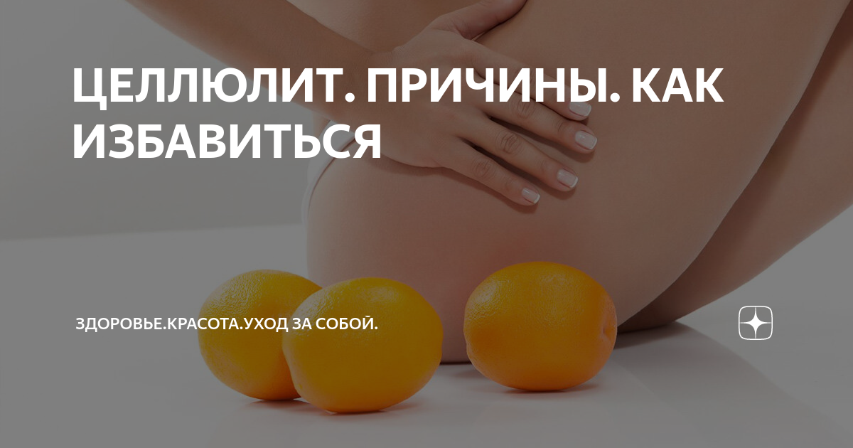 ЦЕЛЛЮЛИТ. ПРИЧИНЫ. КАК ИЗБАВИТЬСЯ | Здоровье.Красота.Уход за собой. | Дзен
