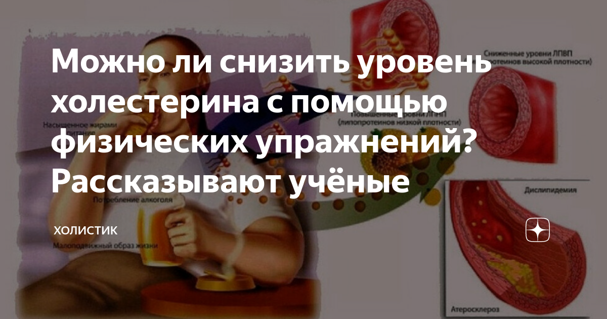 Убийцы холестерина продукты. Холестерин яйца у мужчин. Как бороться с холестерином после 50 лет у женщин.