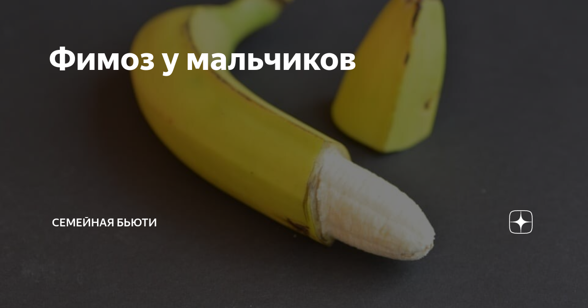 Фимоз у мальчиков | Семейная Бьюти | Дзен