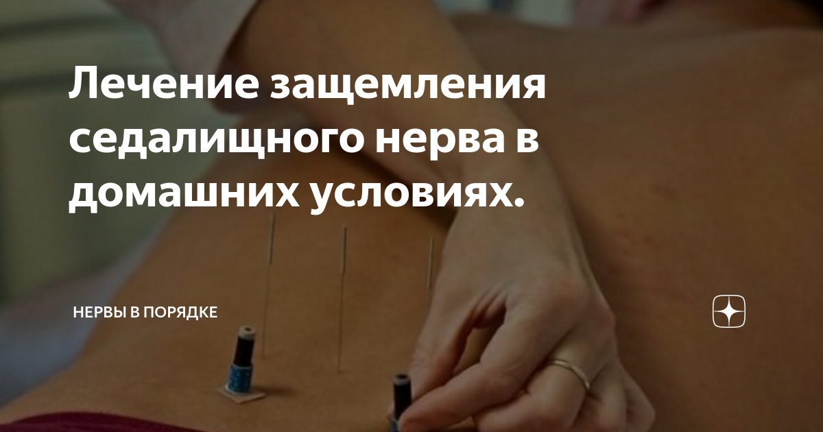 Воспаление седалищного нерва: симптомы и эффективные методы лечения - MEDСЕМЬЯ