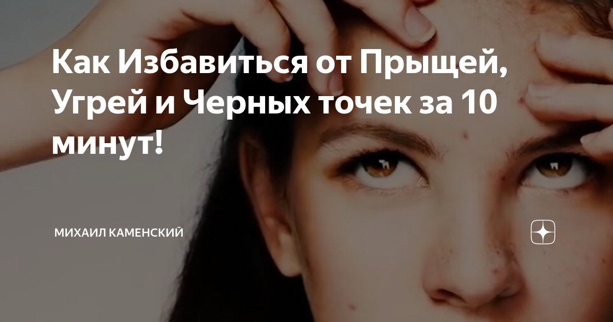 Как Избавиться от Прыщей, Угрей и Черных точек за 10 минут! | Михаил ...