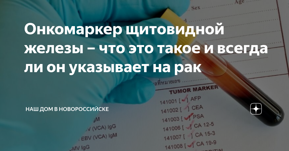 Онкомаркеры са 50 для женщин. Онкомаркер щитовидной железы. Онкомаркёры щитовидной железы. Опухоли щитовидной железы онкомаркеры. Онкомаркеры для женщин щитовидной железы.