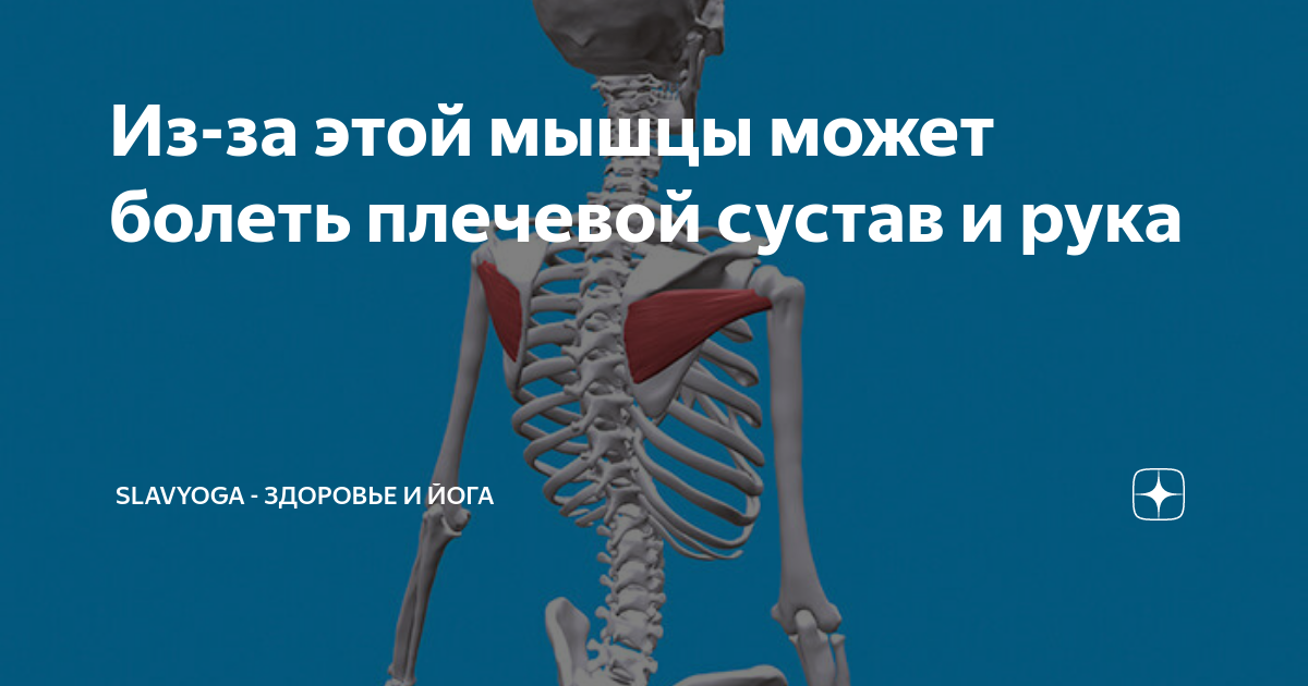 болит подостная мышца