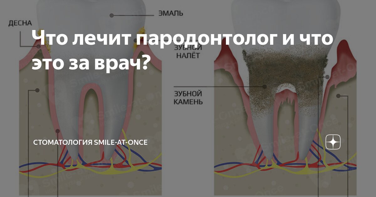 Чем занимается стоматолог-пародонтолог? | Блог DentArt | Киев