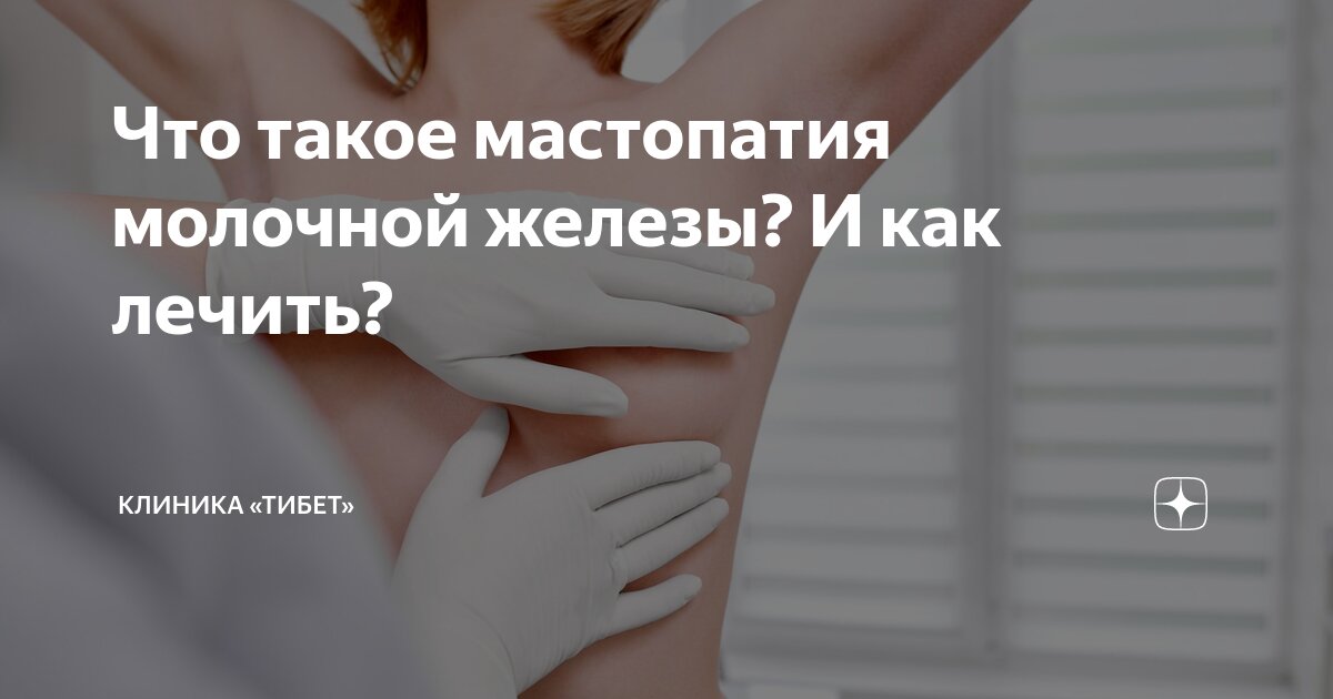 Кистозная мастопатия