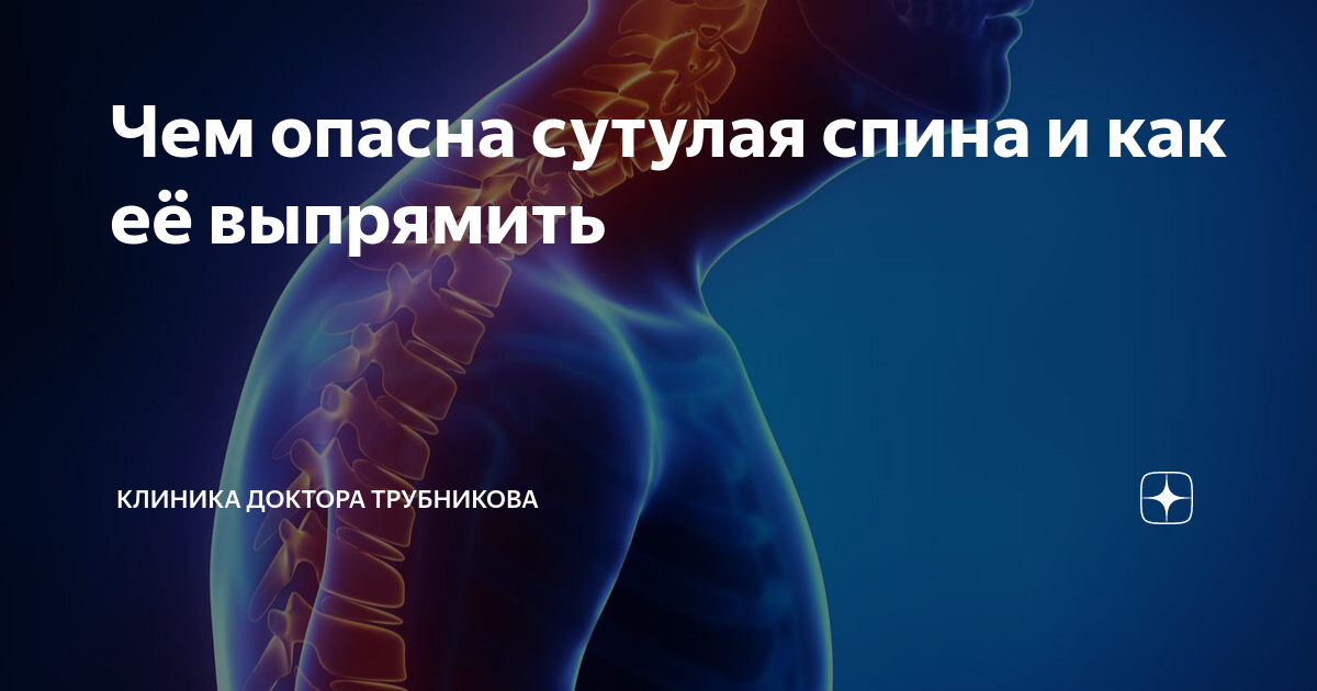 Чем опасна сутулая спина и как её выпрямить | Клиника доктора ...