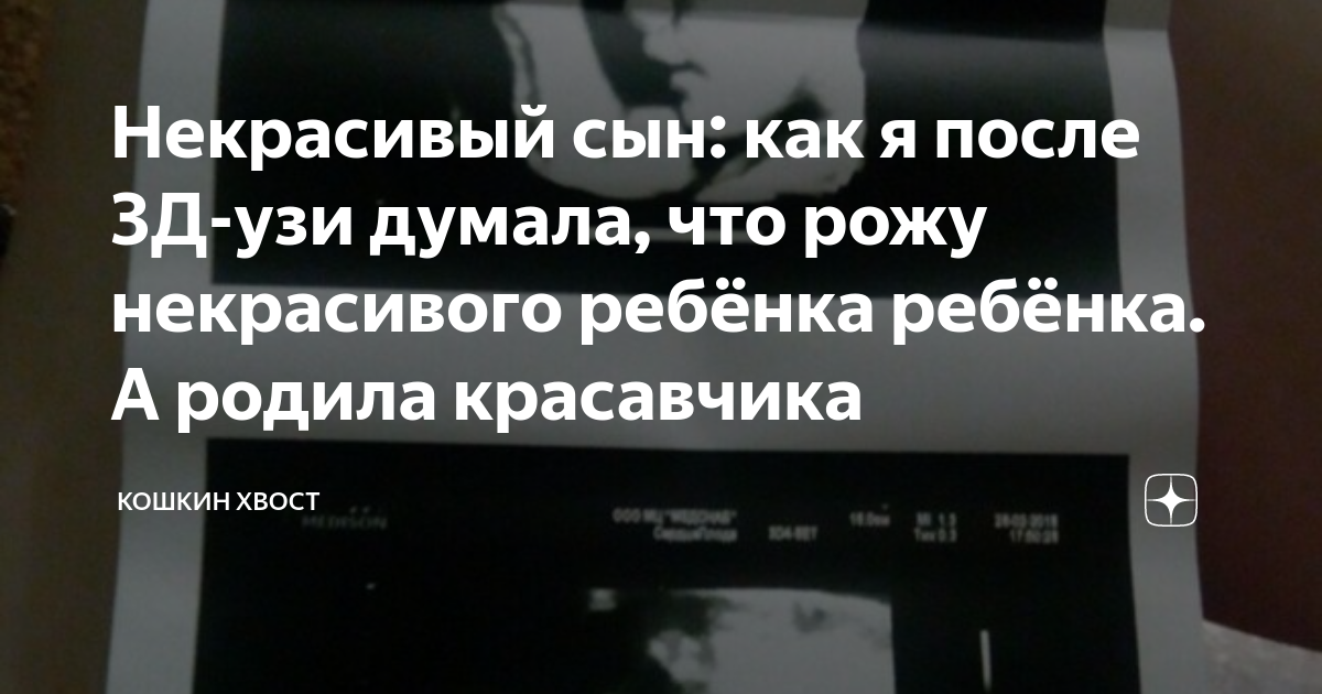 Некрасивый сын: как я после 3Д-узи думала, что рожу некрасивого ребёнка ...