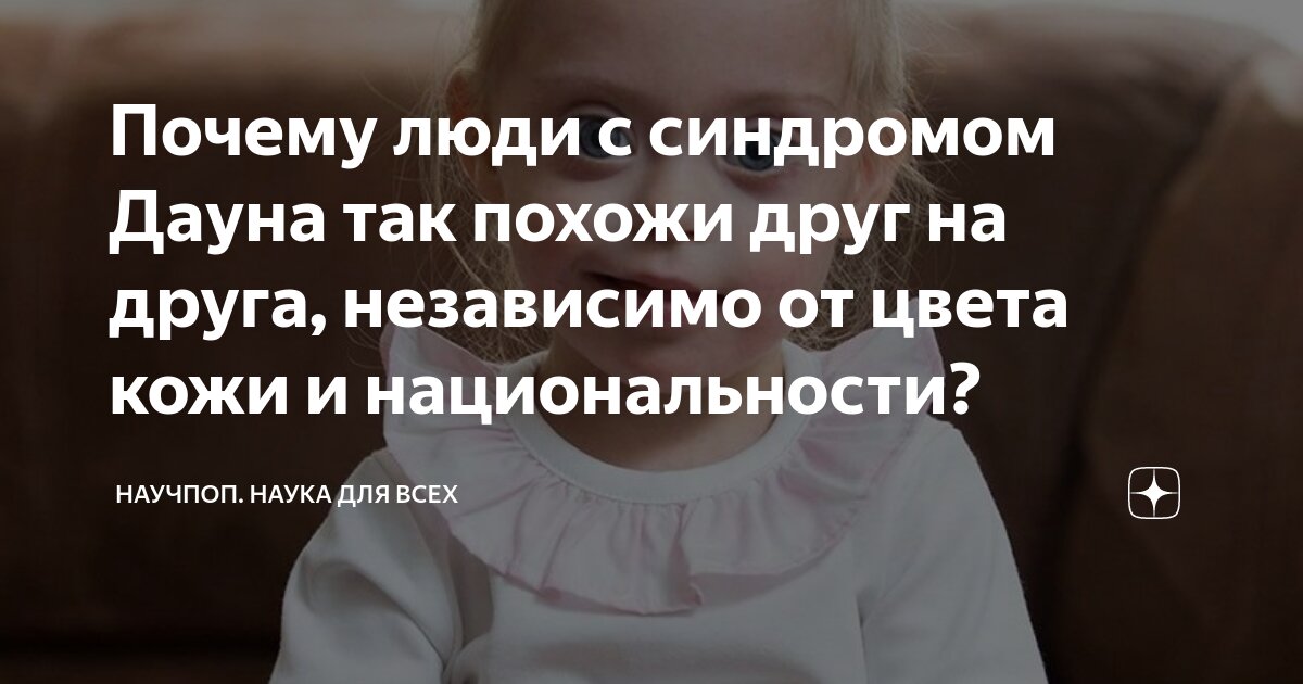 почему люди с синдромом дауна похожи между собой