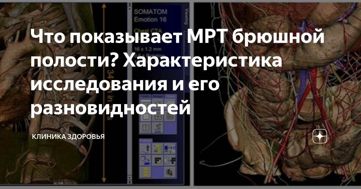 забрюшинное пространство мрт что входит