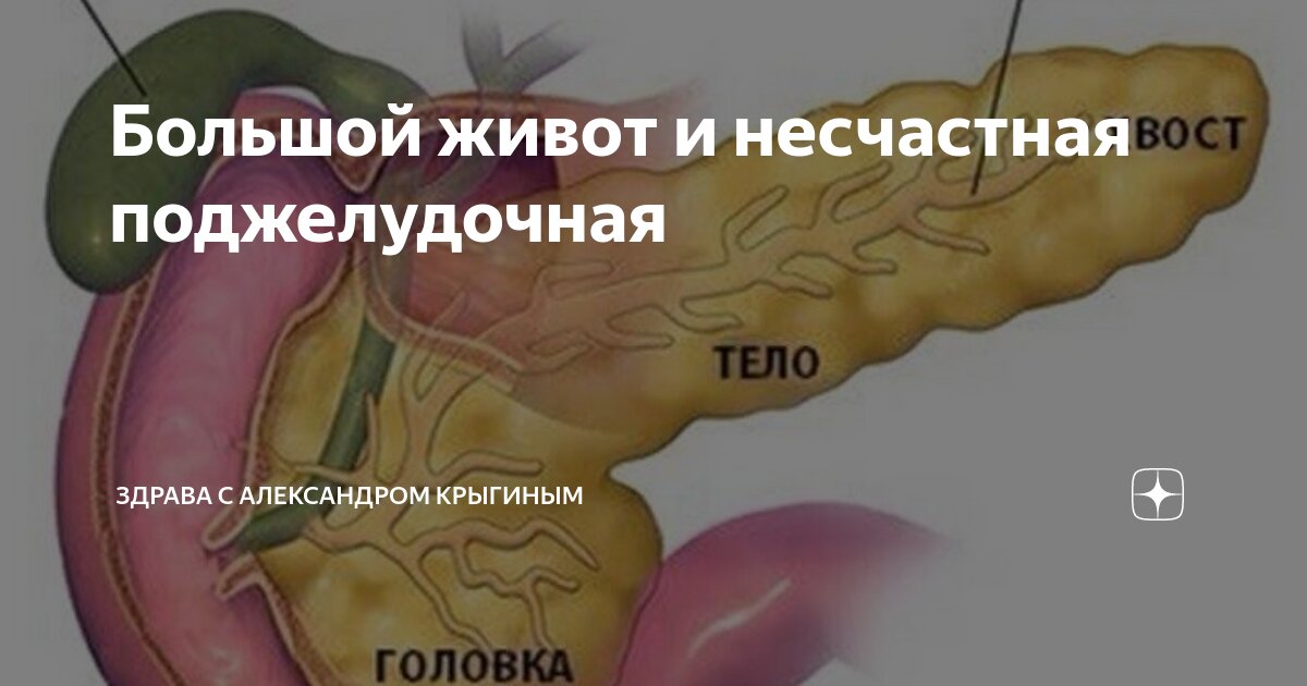 Большой живот и несчастная поджелудочная | здрава с Александром ...