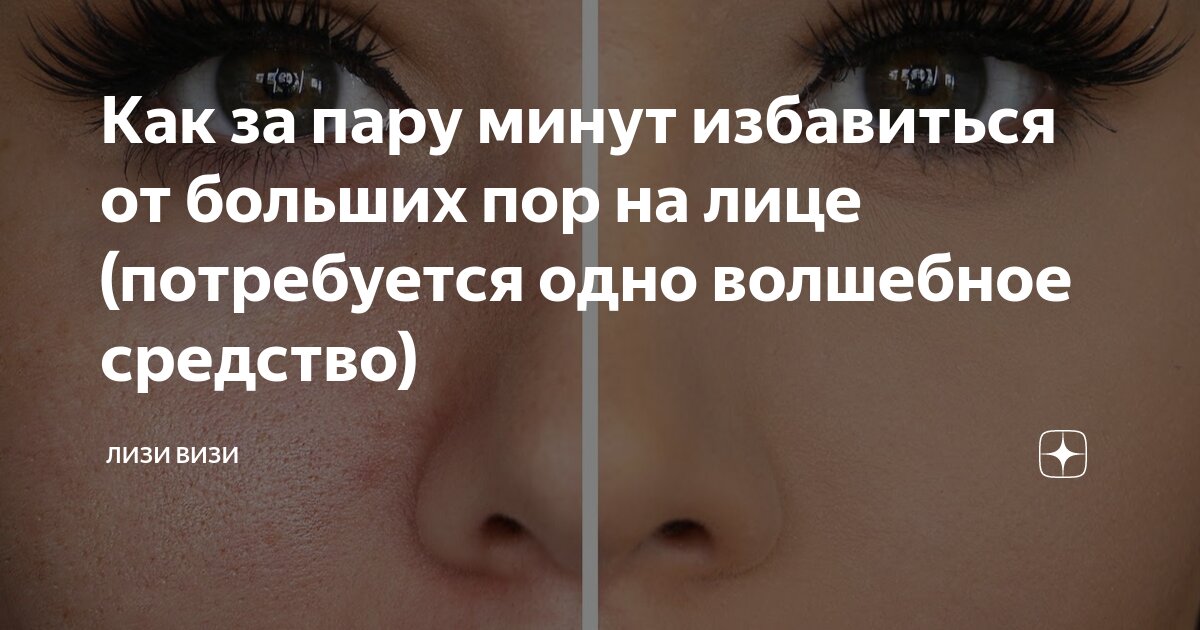 Как за пару минут избавиться от больших пор на лице (потребуется одно ...