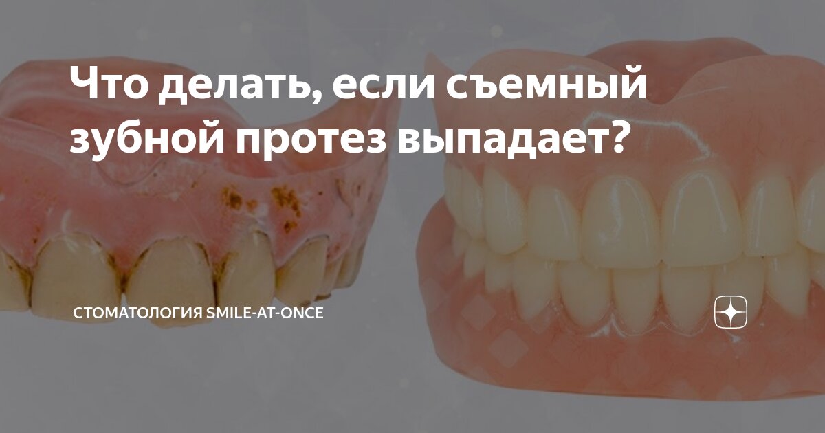 Что делать, если съемный зубной протез выпадает?