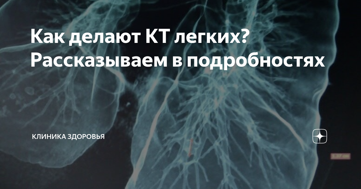 кт легких с контрастом как делают