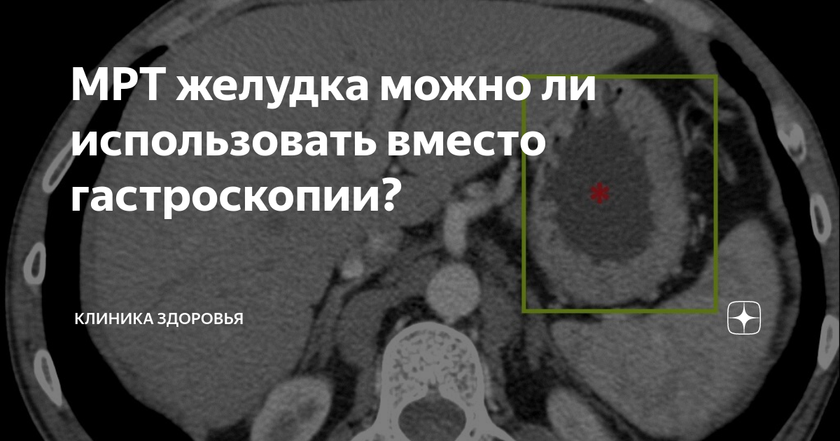 после мрт можно пить