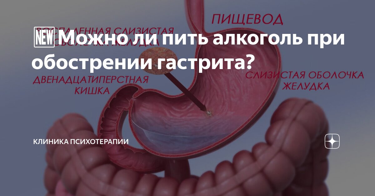 нужно ли вызывать скорую при обострении гастрита