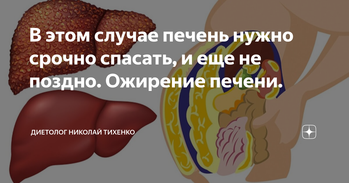Неалкогольная жировая болезнь печени Мукофальк