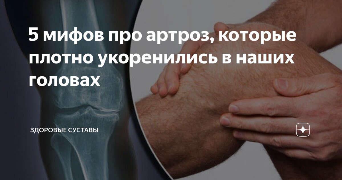 как я живу с артрозом