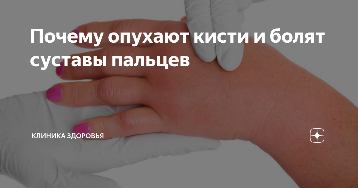 опухла и болит кисть левой руки
