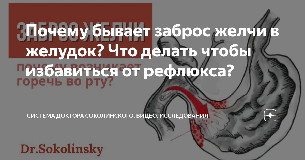 Заброс желчи в горло. Система Соколинского. Операция на желудок при забросе желчи. Почему желчь забрасывается в желудок причины и что делать.