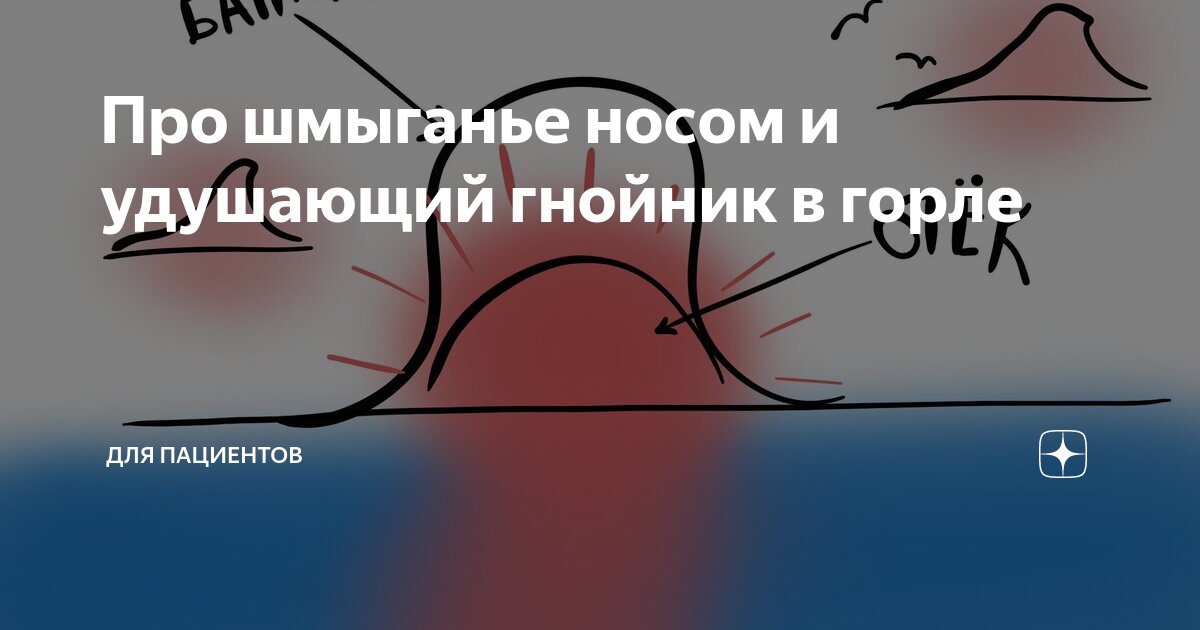 Про шмыганье носом и удушающий гнойник в горле | Для пациентов | Дзен