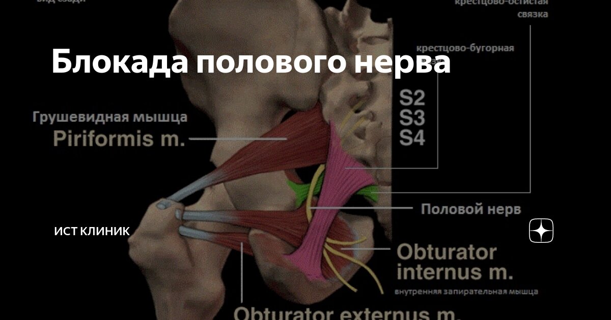 Блокада полового нерва | Ист Клиника - неврология, ортопедия ...