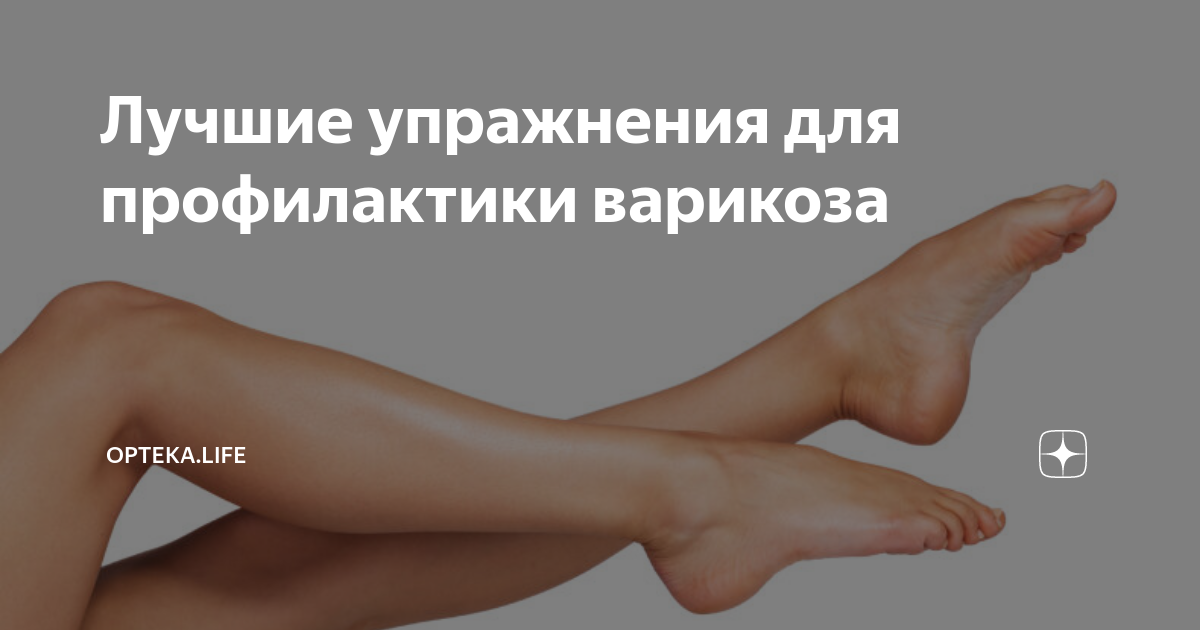 упражнения для ног и ягодиц при варикозе