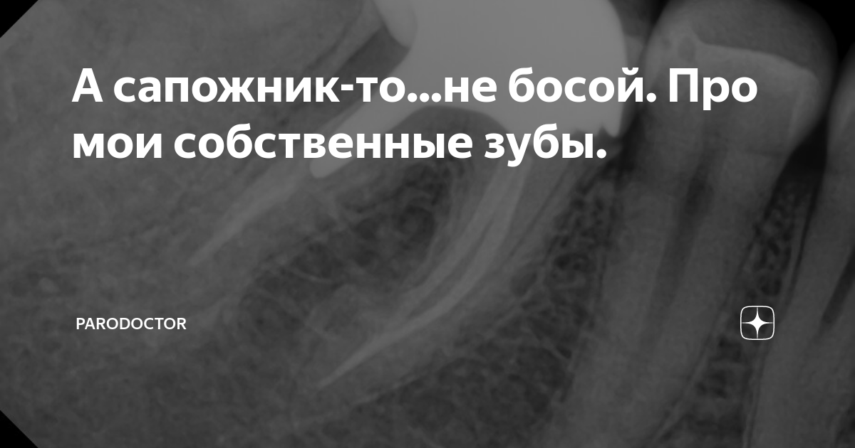 А сапожник-то...не босой. Про мои собственные зубы. | Parodoctor | Дзен