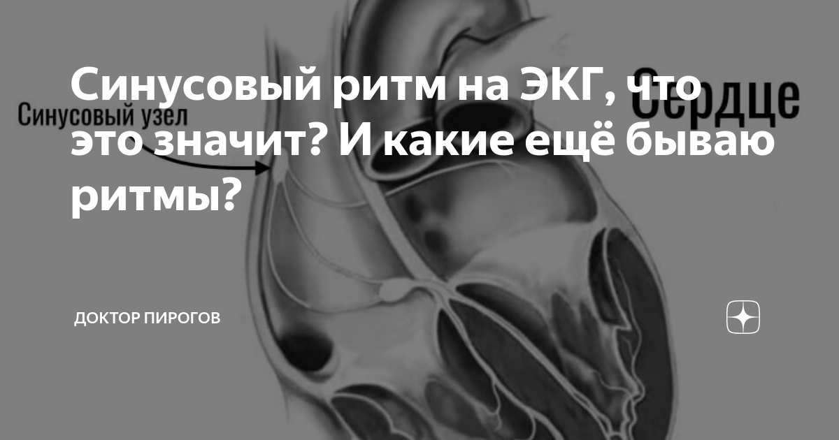 Регулярность ритма нет что значит. Регулярность ритма нет что значит