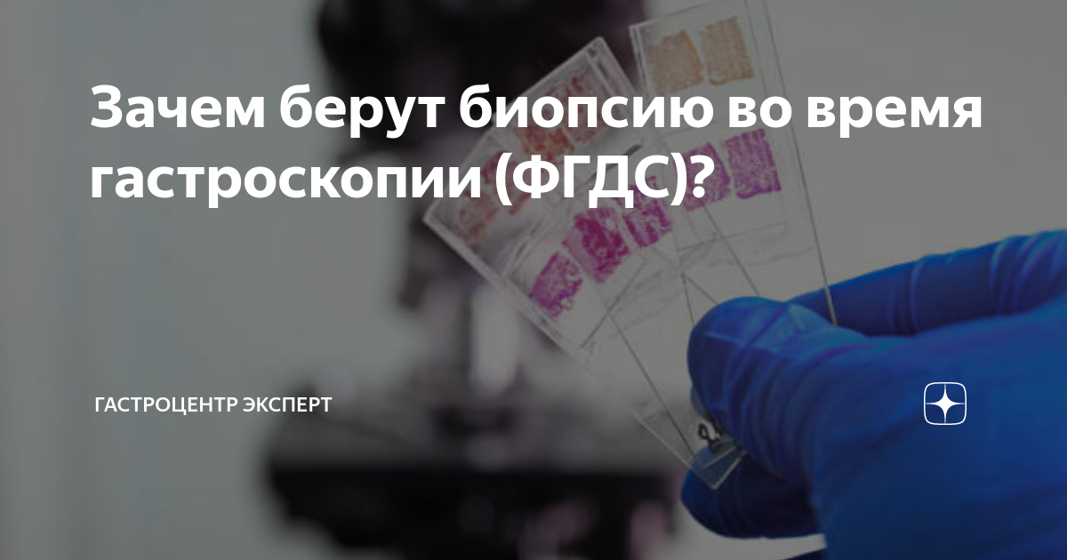 Зачем берут биопсию во время гастроскопии (ФГДС)? | Гастроцентр Эксперт ...