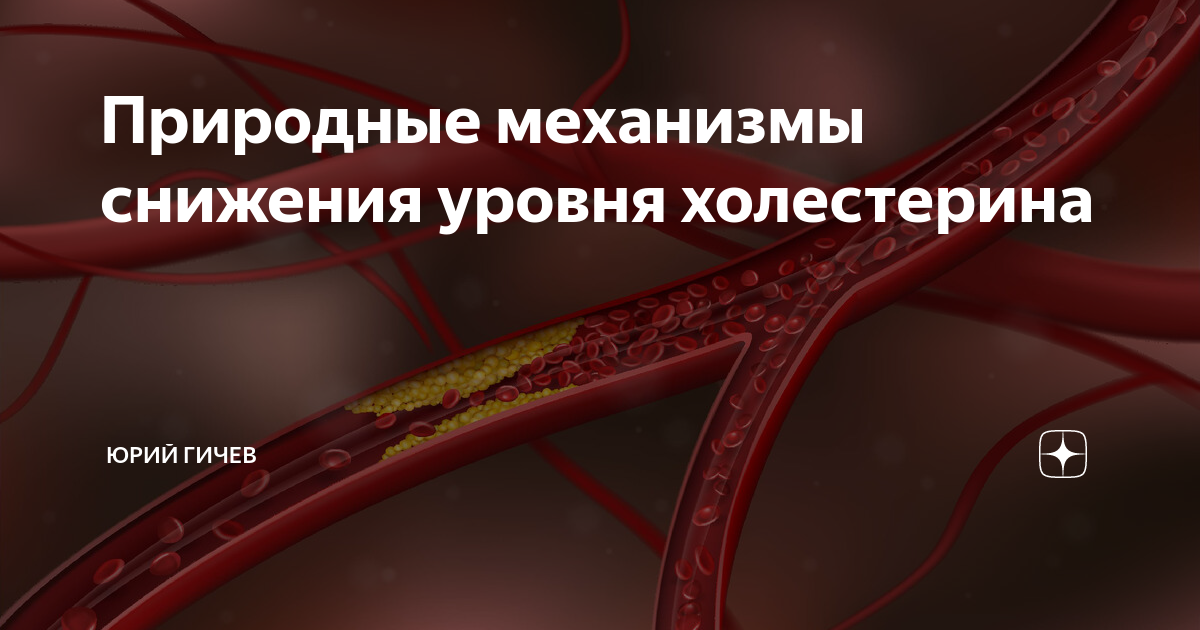 простые механизмы примеры. природно-техническая система. изменение величины предложения. природные механизмы. природные механизмы.