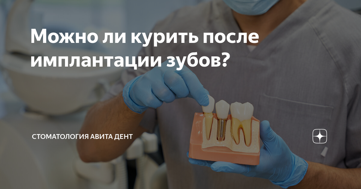 когда можно курить кальян после имплантации