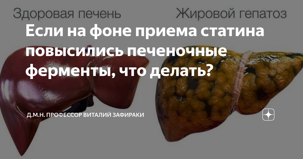 Когда барахлит печень: гастроэнтеролог назвала 4 частых причины, почему повышены АЛТ и АСТ в крови