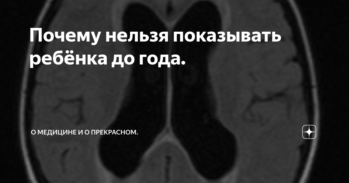 Почему детей до года не показывали посторонним — Кириллица — энциклопедия русской жизни