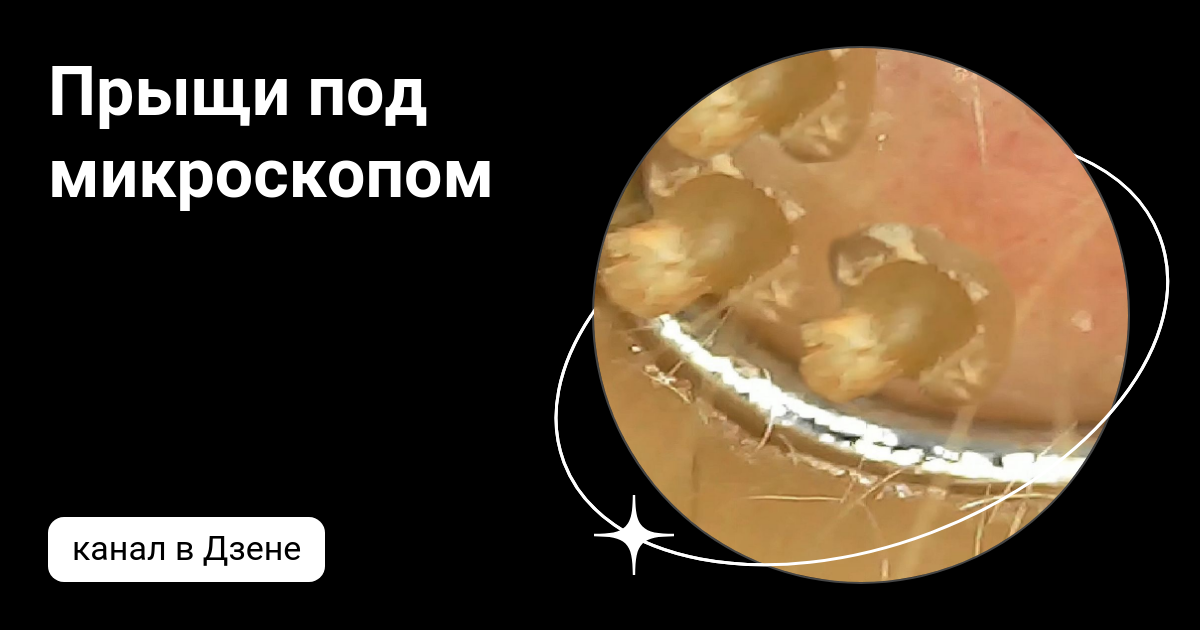 Чистка лица под микроскопом Как японки умудряются выглядеть так молодо 6 восточных хитростей Путешествия, т