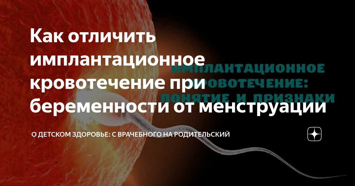 Как отличить имплантационное кровотечение при беременности от ...
