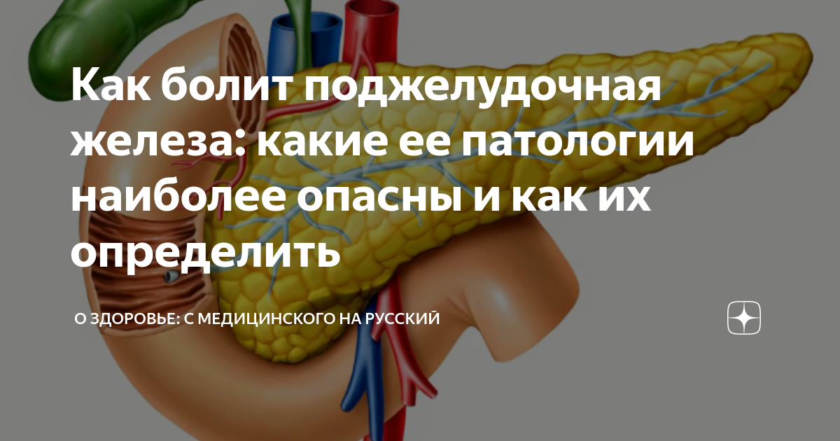 Поджелудочная отзывы. Продукты восстанавливающие поджелудочную железу. Еда для восстановления поджелудочной железы.