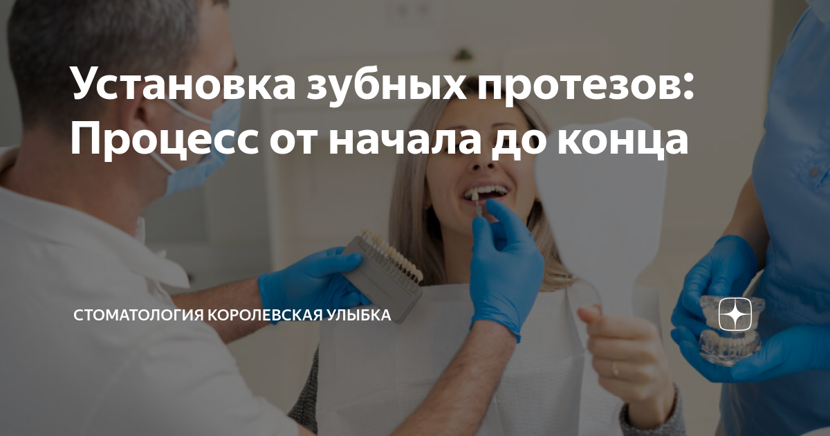 Установка зубных протезов: Процесс от начала до конца | Стоматология ...