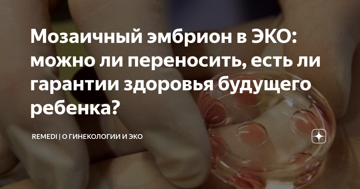 Закон о признании эмбриона на жизнь. Мозаичный эмбрион