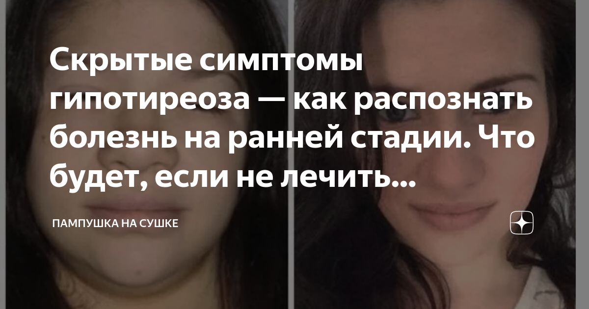 Скрытые симптомы гипотиреоза — как распознать болезнь на ранней стадии ...
