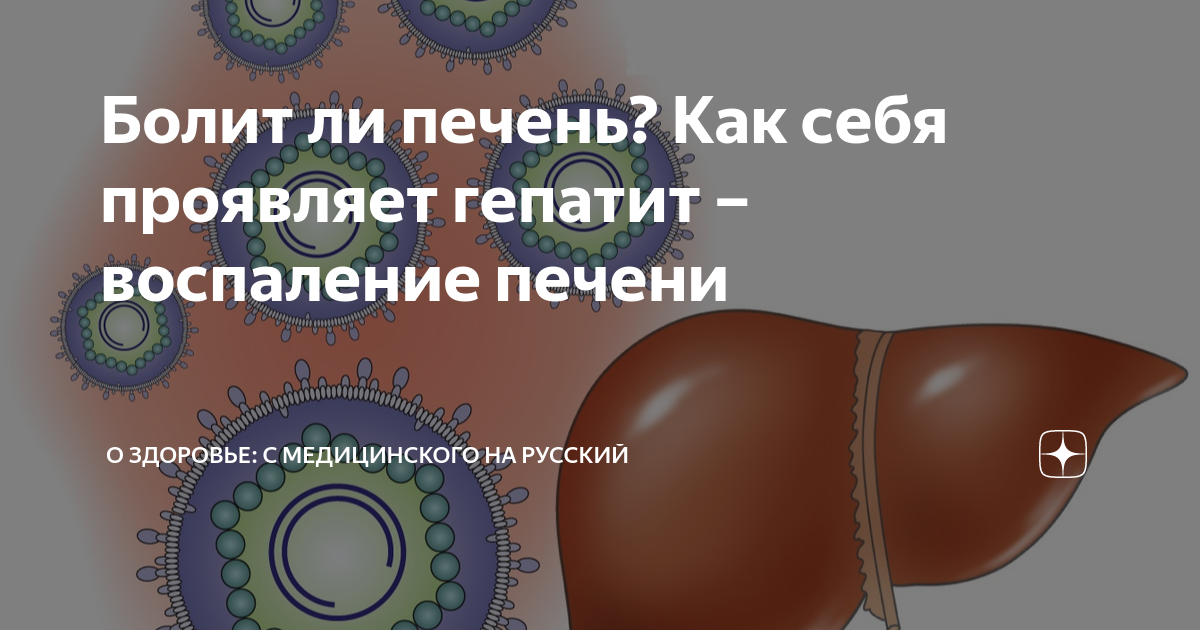Болит ли печень? Как себя проявляет гепатит – воспаление печени | О ...