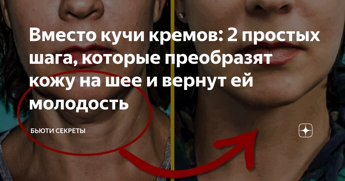 как убрать гусиную кожу на шее и декольте