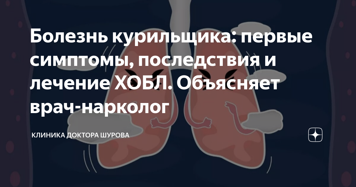 Болезнь курильщика: первые симптомы, последствия и лечение ХОБЛ ...