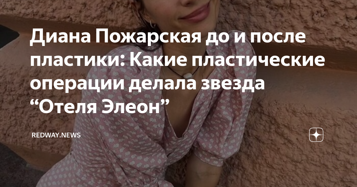 Диана пожарская до и после пластики носа губ 54 фото - wForm.ru